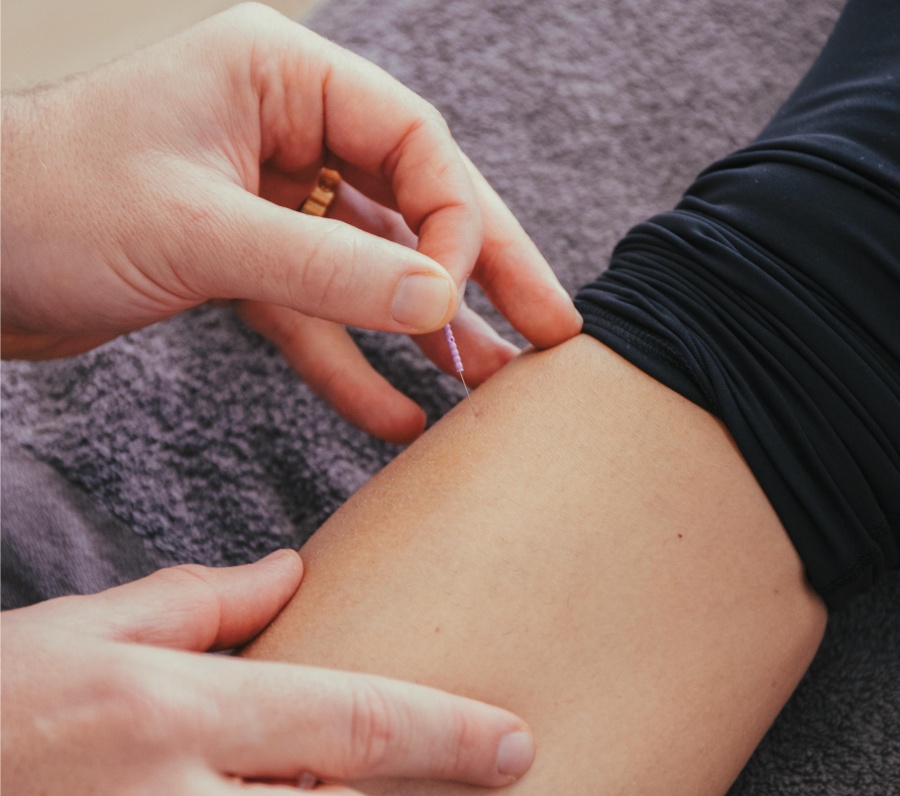 Dry needling services