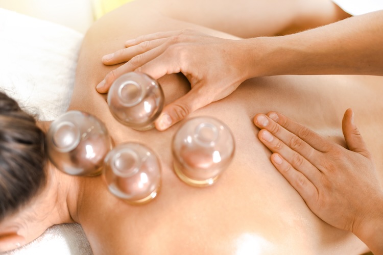 Cupping Therapy